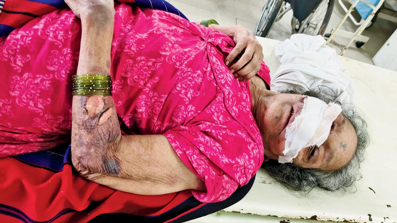 ​Nagpur cancer hospital offers ‘dumped’ granny free treatment 