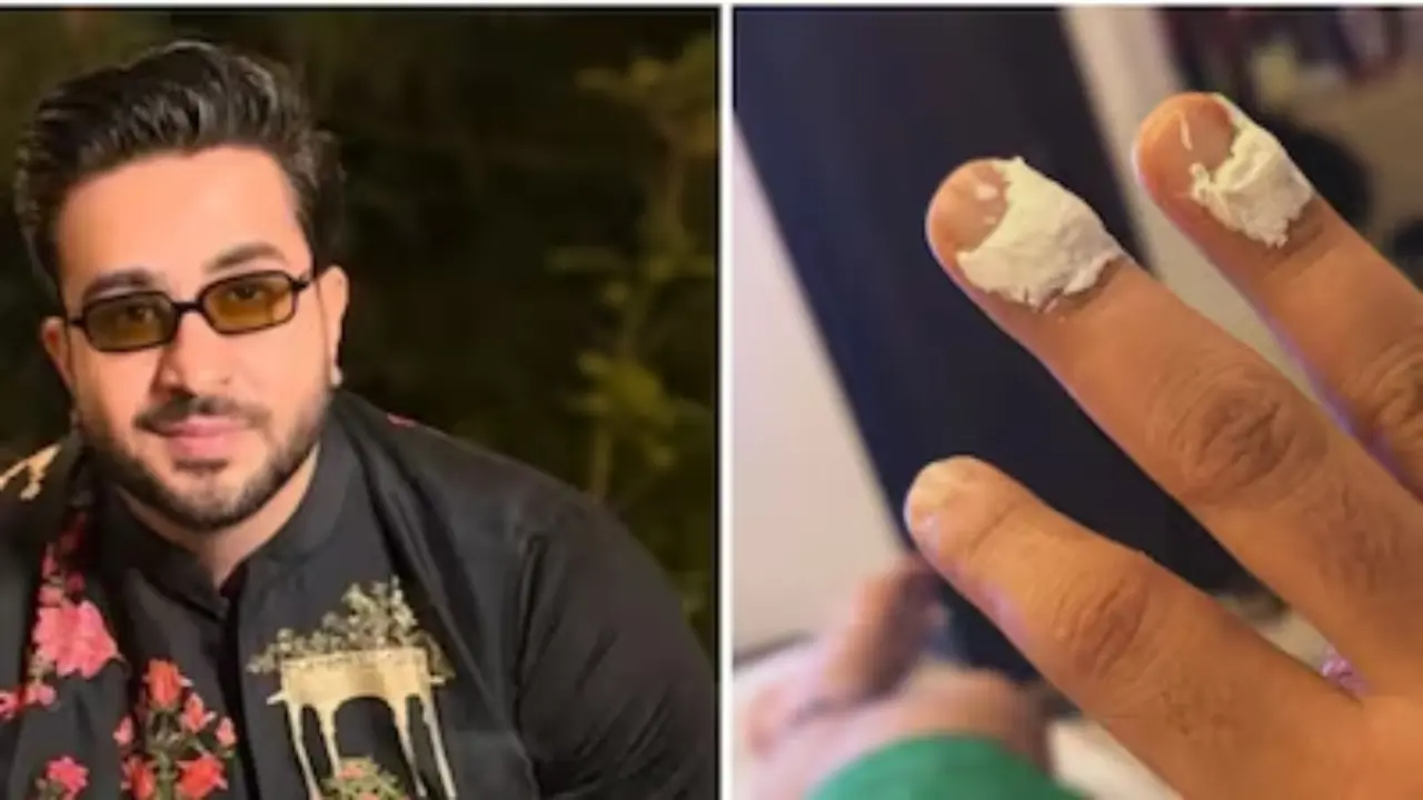 Aly Goni burns his fingers while frying pakode on the sets of Laughter Chefs 3 