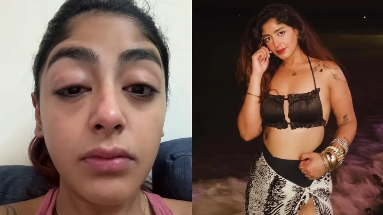 Splitsvilla X6 fame Preet Singh alleges attack during night out, gets bruised 